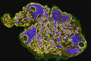Ganglion in der menschlichen Harnblase, Falschfarbendarstellung. Indirekte FITC-Immunfluoreszenz, Antik&ouml;rper gegen Neurofilament-Proteine. (c) Univ.-Prof. Dr. Gerhard W. Hacker, Salzburg.