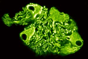 Ganglion in der menschlichen Harnblase, dargestellt mit indirekter FITC-Immunfluoreszenz und Antik&ouml;rpern gegen Neurofilament-Proteine. (c) Univ.-Prof. Dr. Gerhard W. Hacker, Salzburg.